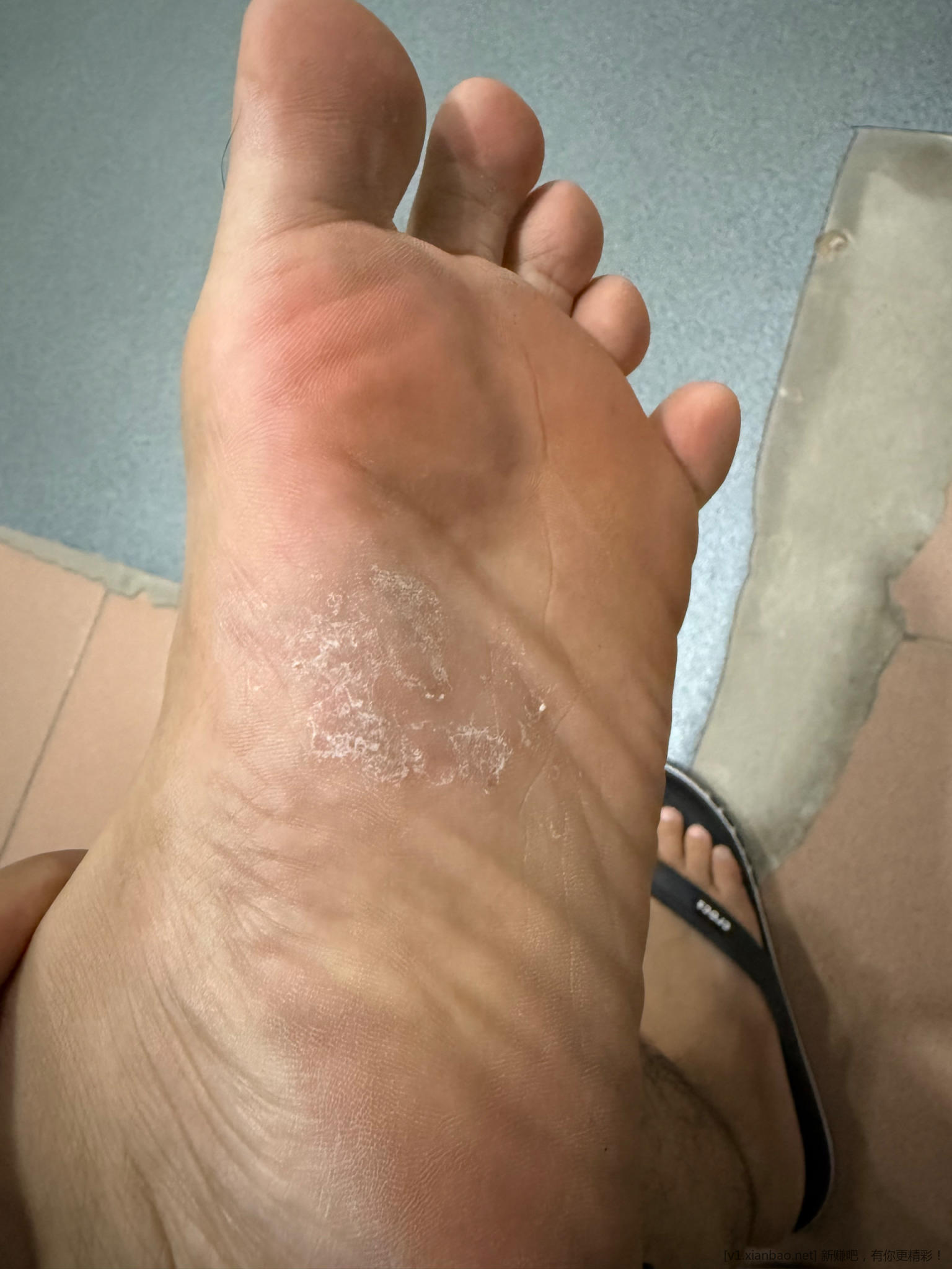 有吧医吗？帮我看看真菌感染这些药能不拿不吃吗 - 线报酷